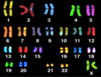 Deep Vein Thrombosis (DVT) diagram