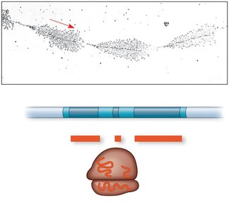 Ribosomal RNA gene family structure