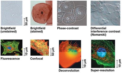 Types of microscopy images