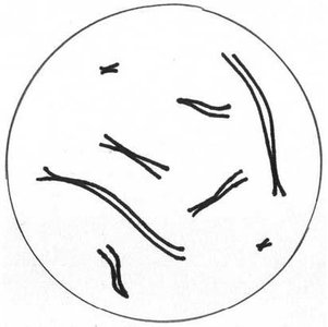 Cell with chromosomes at metaphase