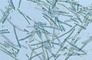 Microscopic image of cyanobacteria