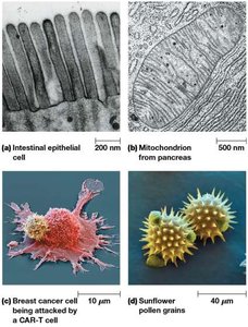 Electron Microscopy examples