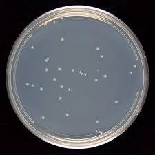 Bacterial colony not present (fitness = 0)