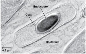 Bacterial endospore within a cell
