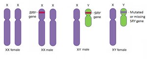 SRY gene and sex determination