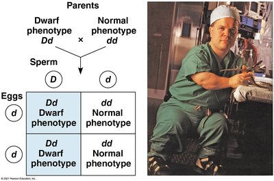 Punnett square for autosomal dominant inheritance (dwarfism)