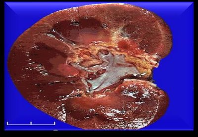 Human kidney