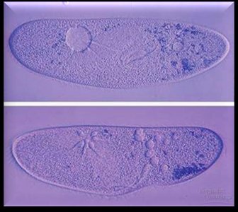 Contractile vacuole in Paramecium