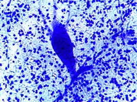 Microscopic image of nerve tissue