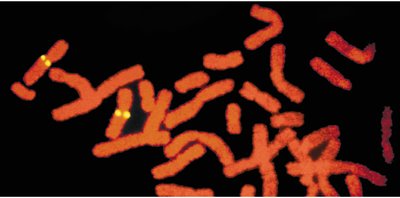 Yellow dots mark one gene on a pair of duplicated homologous chromosomes