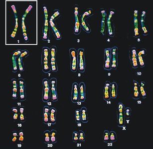 Human karyotype showing chromosome pairs
