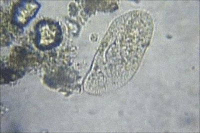 Competitive exclusion in laboratory populations of Paramecium