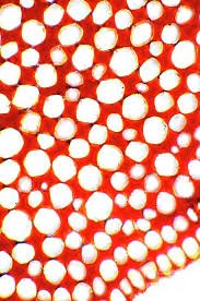 Microscopic view of collenchyma cells