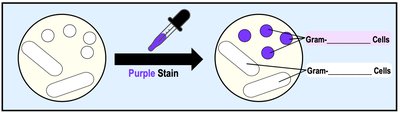 Gram positive vs. Gram negative cell wall structure