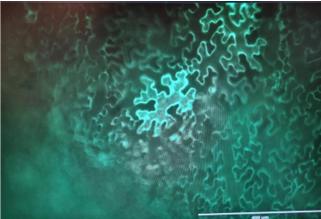 Microscopic view of GFP expression in plant epidermal cells