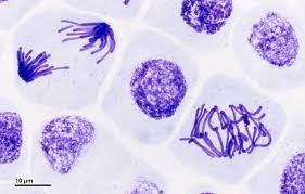 Light micrograph of cells in various stages of mitosis