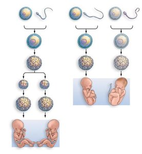 Diagram showing development of monozygotic and dizygotic twins