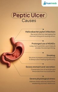 Infographic summarizing causes of peptic ulcers