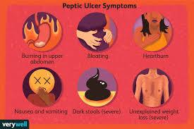 Infographic showing symptoms of peptic ulcers: burning, bloating, heartburn, nausea, dark stools, weight loss
