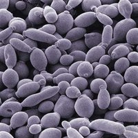 Yeast cells undergoing budding