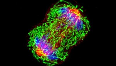 Fluorescent micrograph of a cell in mitosis