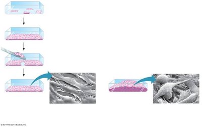 Diagram showing normal and cancer cell growth in culture