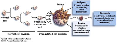 Diagram of tumor progression and metastasis