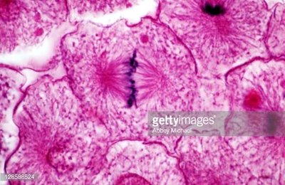 Photomicrograph of metaphase in onion root tip