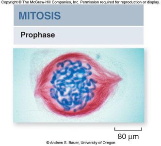 Prophase: chromosomes visible, spindle forming