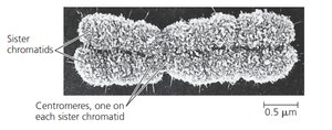 Electron micrograph of a chromosome with sister chromatids and centromeres