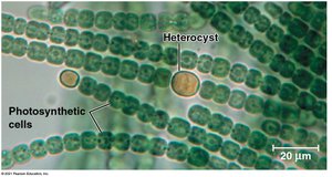 Anabaena filament with heterocysts and photosynthetic cells