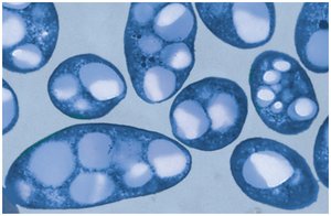 Bacteria producing bioplastics