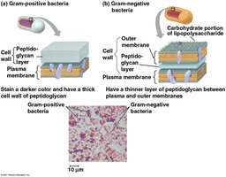 Gram-positive vs Gram-negative bacterial cell walls