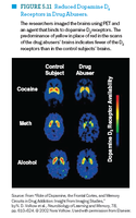 PET scans showing reduced dopamine D2 receptors in drug abusers