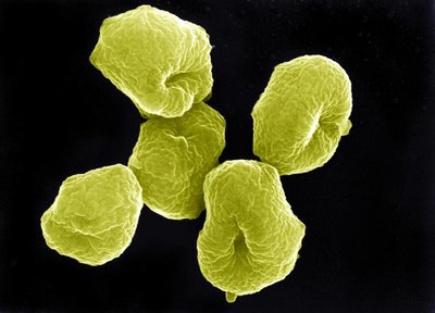 Cyanobacteria under microscope