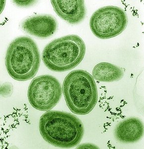 Filamentous cyanobacteria