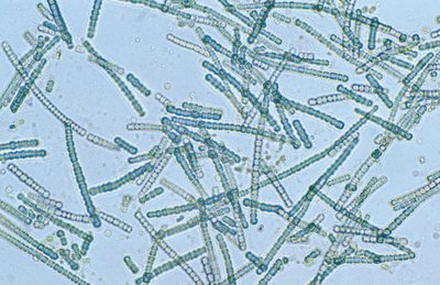 Harmful algal bloom caused by cyanobacteria