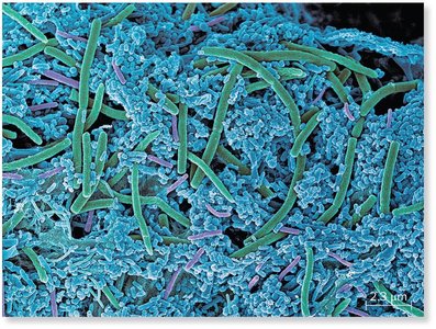 Biofilm formation by bacteria