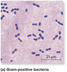 Gram-positive bacteria under microscope