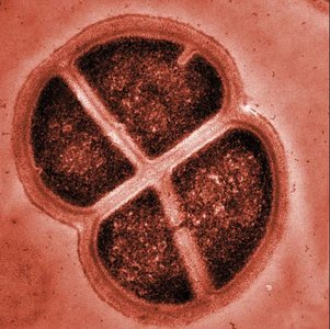 Deinococcus radiodurans, a radiation-resistant bacterium