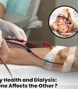Close-up of dialysis procedure