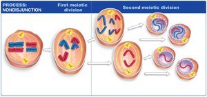 Diagram of nondisjunction during meiosis
