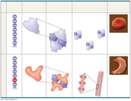 Sickle-cell disease: change in protein structure