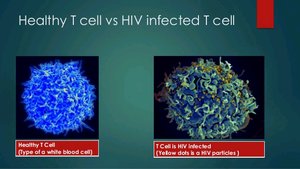 Healthy T cell vs HIV infected T cell
