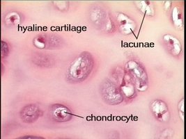 Hyaline cartilage and its perichondrium showing appositional and interstitial growth
