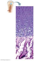 Growth in length of a long bone at the epiphyseal plate