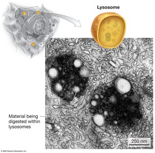 Lysosome structure and electron micrograph