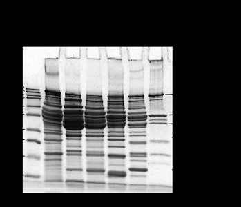 SDS-PAGE gel of fish muscle proteins
