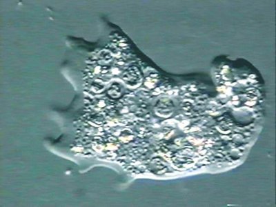Amoeba under microscope