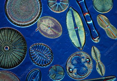 Diatoms under microscope